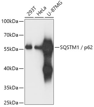 SQSTM1 Antibody