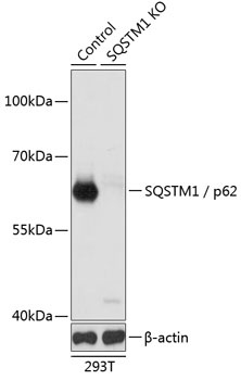 SQSTM1 Antibody