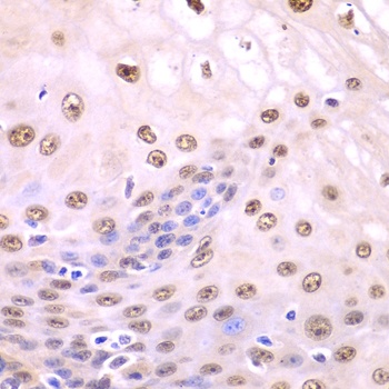 SQSTM1 Antibody