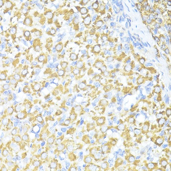 SQSTM1 Antibody
