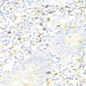 SQSTM1 Antibody