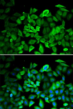 ANXA1 Antibody