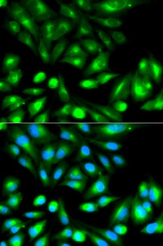 RHOC Antibody