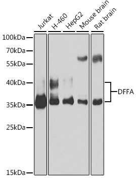 DFFA Antibody