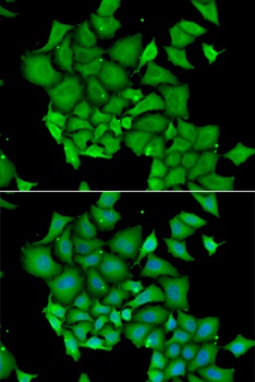DFFA Antibody