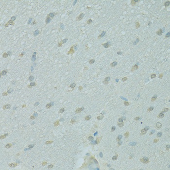 NCOA2 Antibody