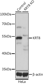 KRT8 Antibody