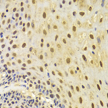KRT8 Antibody
