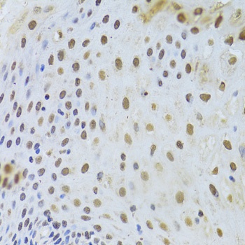 KRT8 Antibody