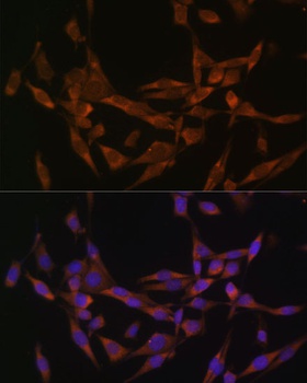UBE2O Antibody