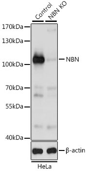 NBN Antibody