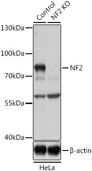 NF2 Antibody