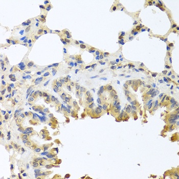 BAX Antibody, KO Validated