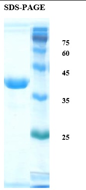 Deamidated Gliadin Peptide Antigen Recombinant Protein
