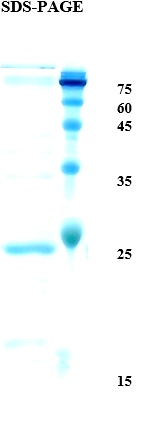 String bean allergen Pha v 3 Recombinant Protein