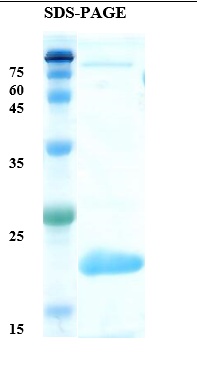 Celery allergen Api g 1 Recombinant Protein