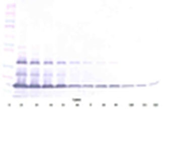 FAS Antibody