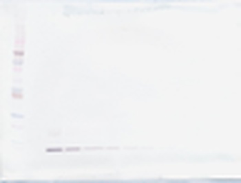 CCL15 Antibody (Biotin)