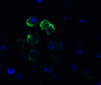 FZD6 Antibody