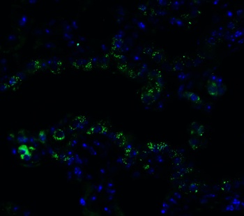 FZD6 Antibody
