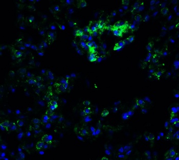 FZD6 Antibody