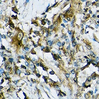 NLRP1 Antibody