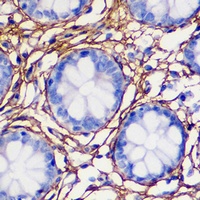 Collagen 1 alpha 1 Antibody