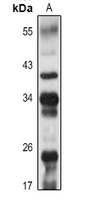 CD20 Antibody