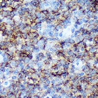 CD20 Antibody