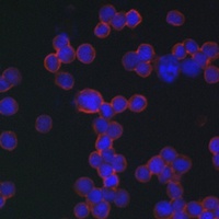 CD20 Antibody