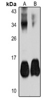Parvalbumin alpha Rabbit Polyclonal Antibody