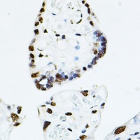 TEAD1 Antibody