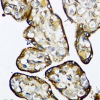 SMAD7 Rabbit Polyclonal Antibody