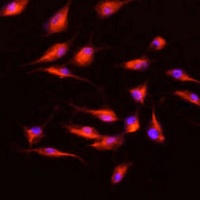 MMP9 Rabbit Polyclonal Antibody
