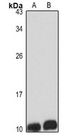 GNGT1 Rabbit Polyclonal Antibody