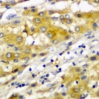 CD107a Rabbit Polyclonal Antibody