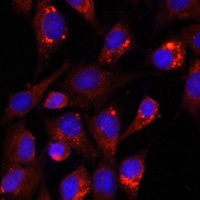 CD107a Rabbit Polyclonal Antibody
