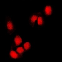 RING1b Antibody