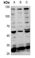 TEAD1 Rabbit Polyclonal Antibody