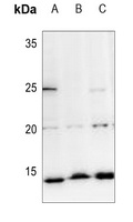 Histone H2A Rabbit Polyclonal Antibody