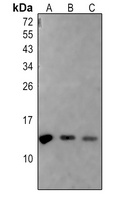 Histone H2A (Acetyl-K5) Rabbit Polyclonal Antibody