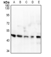 IL-1R2 Antibody