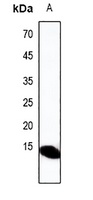 Defensin alpha 3 Rabbit Polyclonal Antibody