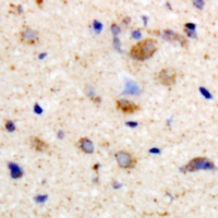 mGLUR2 Rabbit Polyclonal Antibody