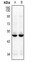 CACNG8 Rabbit Polyclonal Antibody