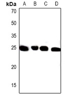 PXMP4 Rabbit Polyclonal Antibody