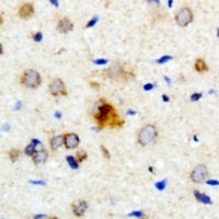 PXMP4 Rabbit Polyclonal Antibody