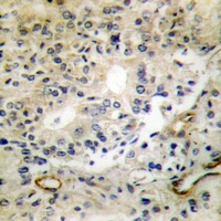 DLEC1 Rabbit Polyclonal Antibody