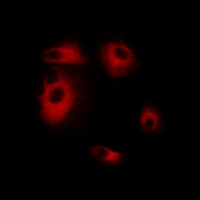 DLEC1 Rabbit Polyclonal Antibody