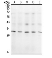 KCHIP1 Rabbit Polyclonal Antibody